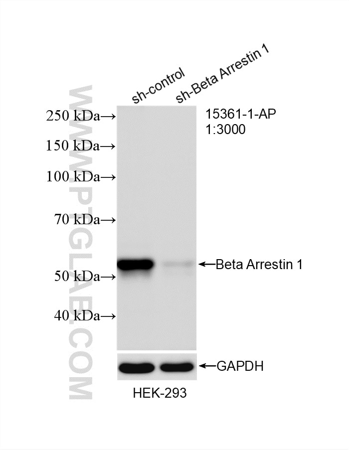 Western Blot (WB) analysis of HEK-293 cells using Beta Arrestin 1 Polyclonal antibody (15361-1-AP)