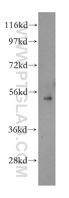Western Blot (WB) analysis of A549 cells using Beta Arrestin 1 Polyclonal antibody (15361-1-AP)