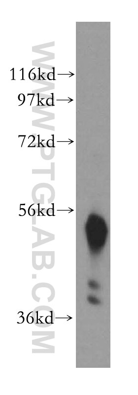 Western Blot (WB) analysis of U-937 cells using Beta Arrestin 1 Polyclonal antibody (15361-1-AP)