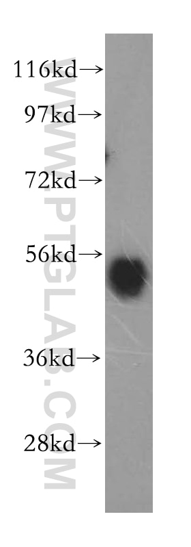 Beta Arrestin 1 Polyclonal antibody