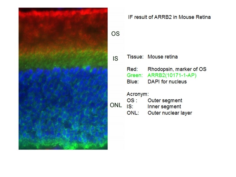 Immunofluorescence (IF) / fluorescent staining of mouse Retina tissue using Beta Arrestin 2 Polyclonal antibody (10171-1-AP)