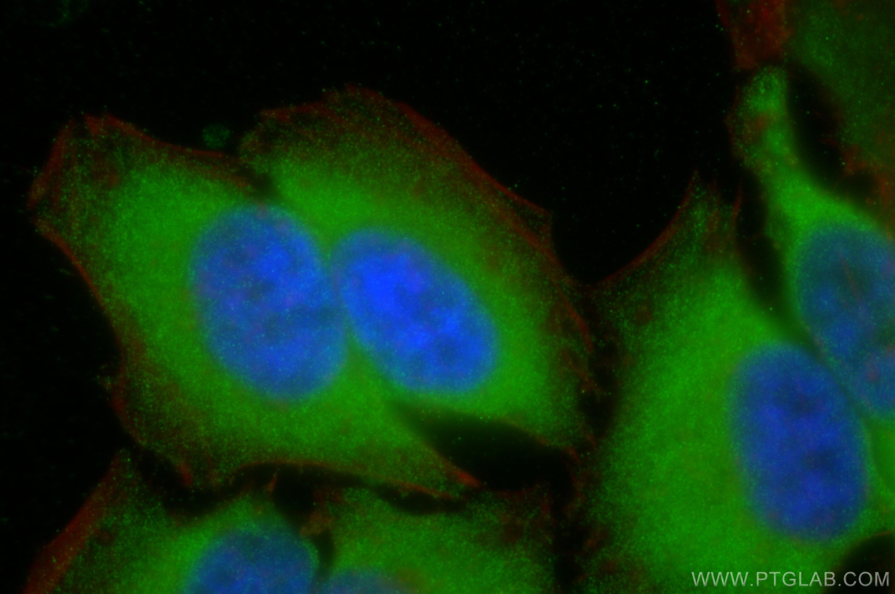 Immunofluorescence (IF) / fluorescent staining of HeLa cells using Beta Arrestin 2 Polyclonal antibody (10171-1-AP)