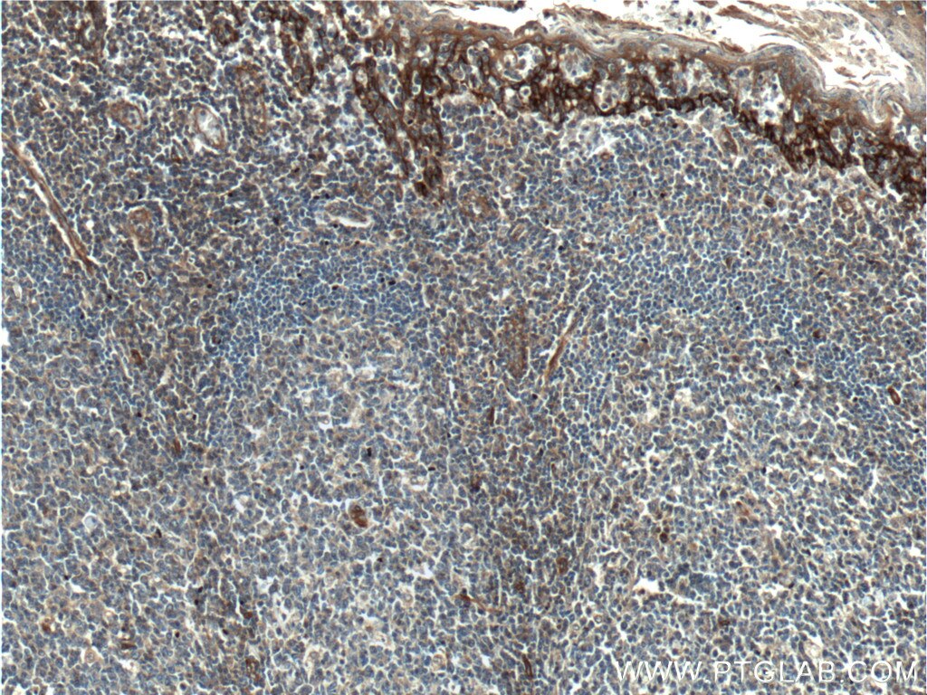 Immunohistochemistry (IHC) staining of human tonsil tissue using Beta Arrestin 2 Polyclonal antibody (10171-1-AP)