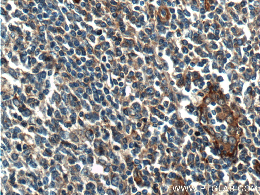 Immunohistochemistry (IHC) staining of human tonsil tissue using Beta Arrestin 2 Polyclonal antibody (10171-1-AP)