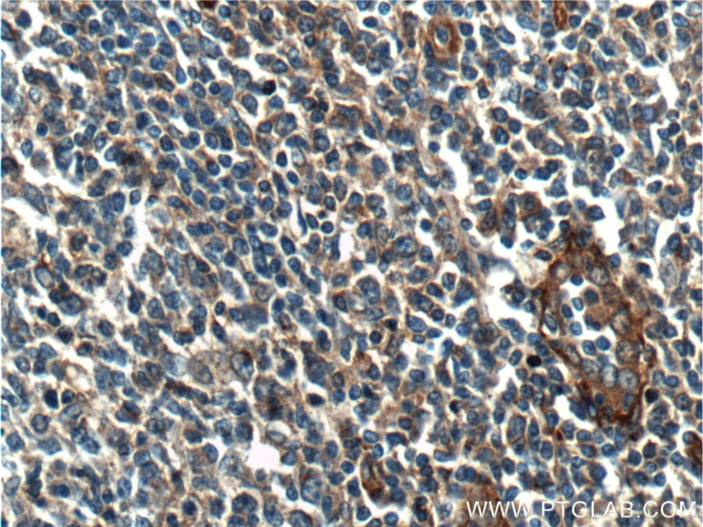 IHC staining of human tonsil using 10171-1-AP