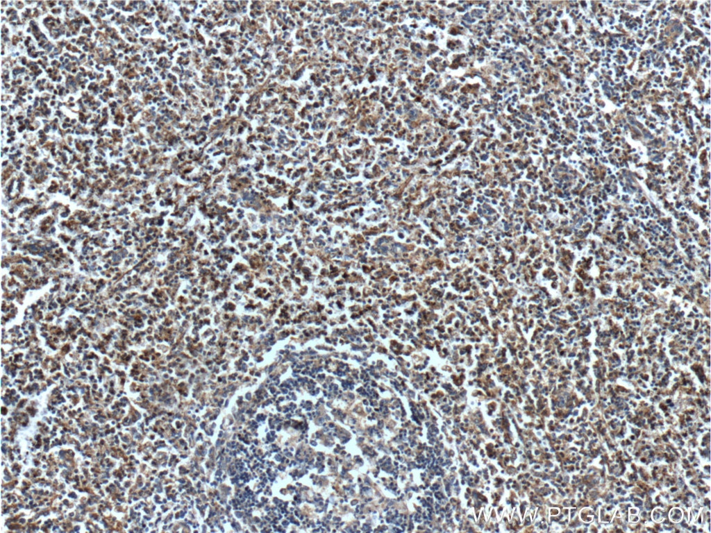 IHC staining of human spleen using 10171-1-AP