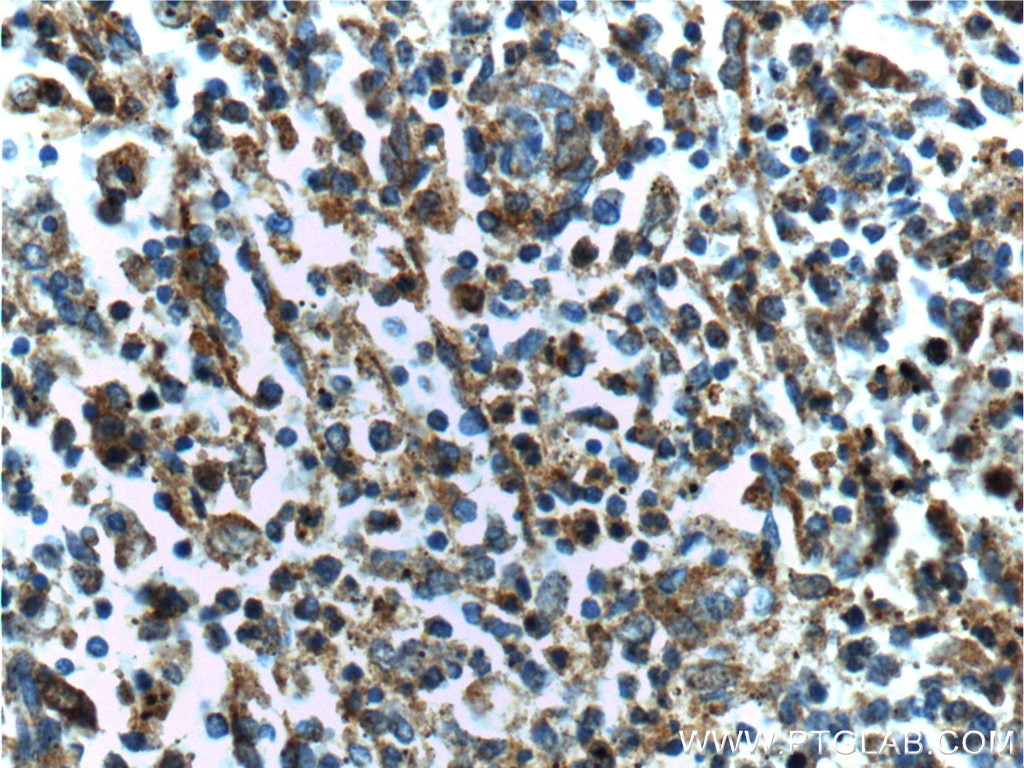 Immunohistochemistry (IHC) staining of human spleen tissue using Beta Arrestin 2 Polyclonal antibody (10171-1-AP)