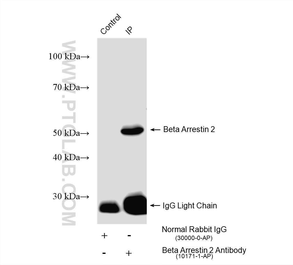 IP experiment of mouse brain using 10171-1-AP Immunoprecipitation (IP) experiment of mouse brain tissue using Beta Arrestin 2 Polyclonal antibody (10171-1-AP)