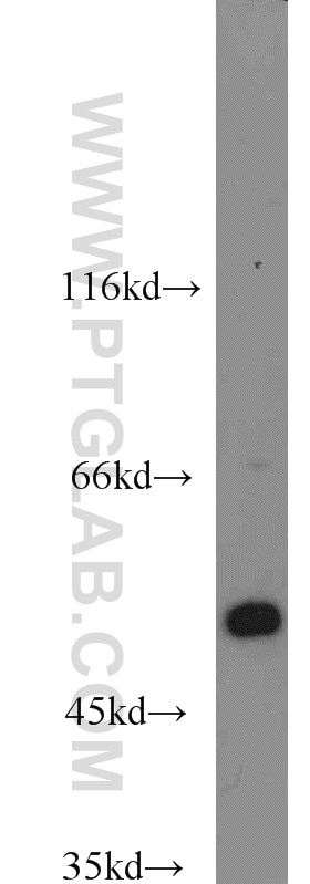 Western Blot (WB) analysis of RAW264.7 using Beta Arrestin 2 Polyclonal antibody (10171-1-AP)