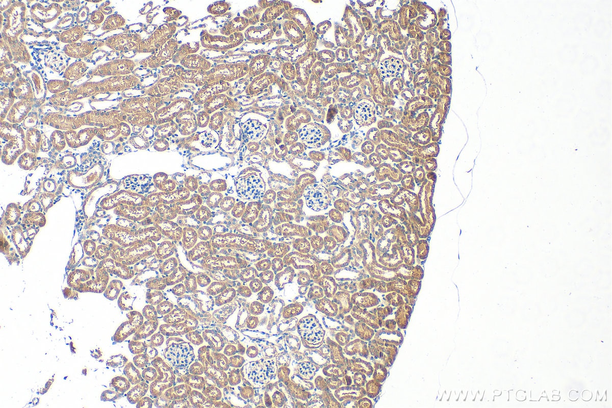 Immunohistochemistry (IHC) staining of mouse kidney tissue using ARRDC1 Polyclonal antibody (21030-1-AP)