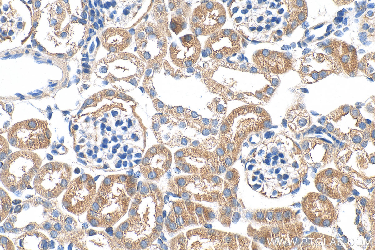 Immunohistochemistry (IHC) staining of mouse kidney tissue using ARRDC1 Polyclonal antibody (21030-1-AP)
