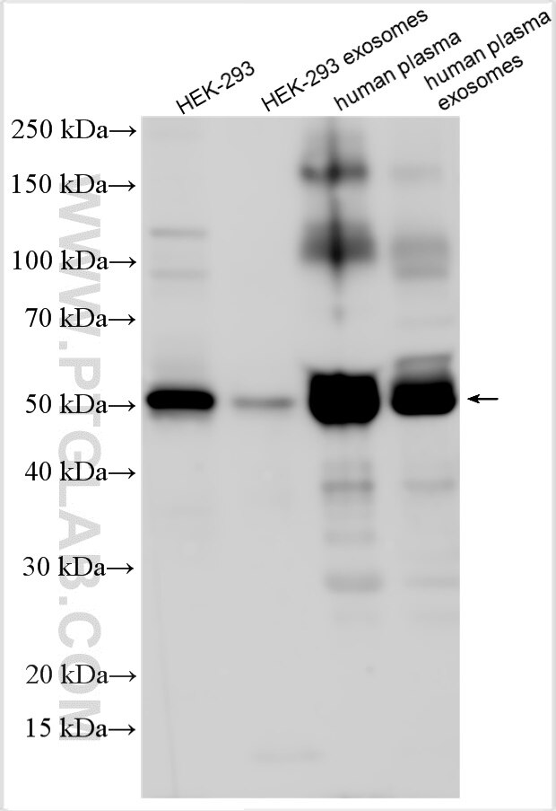 Western Blot (WB) analysis of various lysates using ARRDC1 Polyclonal antibody (21030-1-AP)