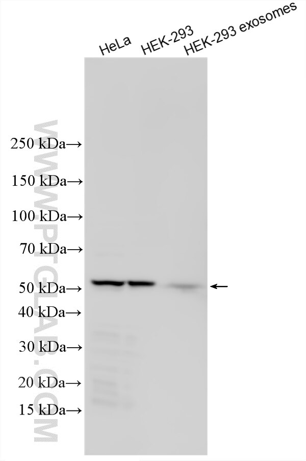 WB analysis using 21030-1-AP (same clone as 21030-1-PBS) Western Blot (WB) analysis of various lysates using ARRDC1 Polyclonal antibody (21030-1-AP)