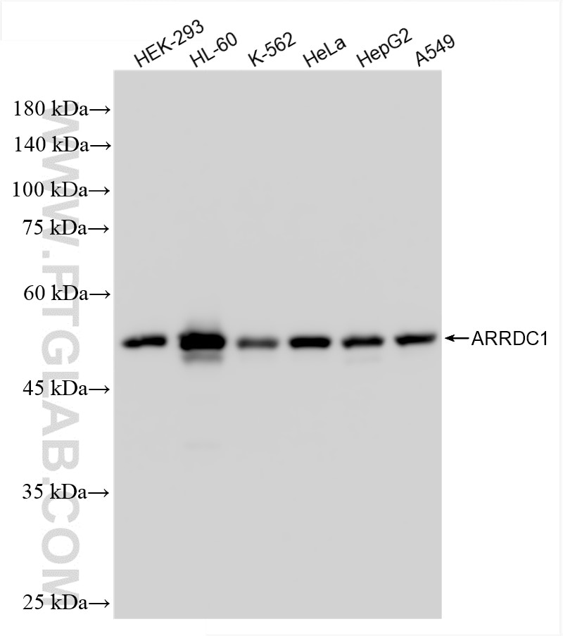 ARRDC1