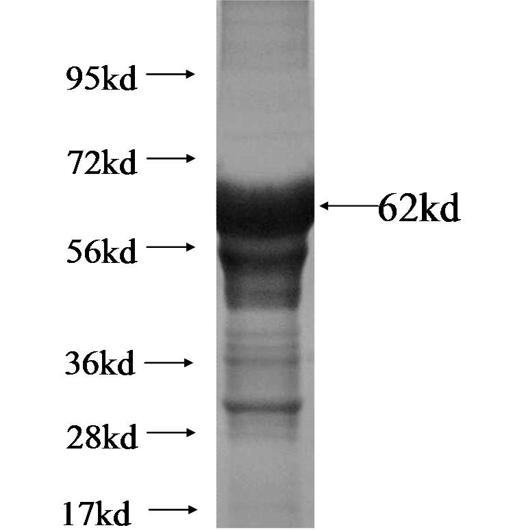 ARRDC2 fusion protein Ag14056 SDS-PAGE