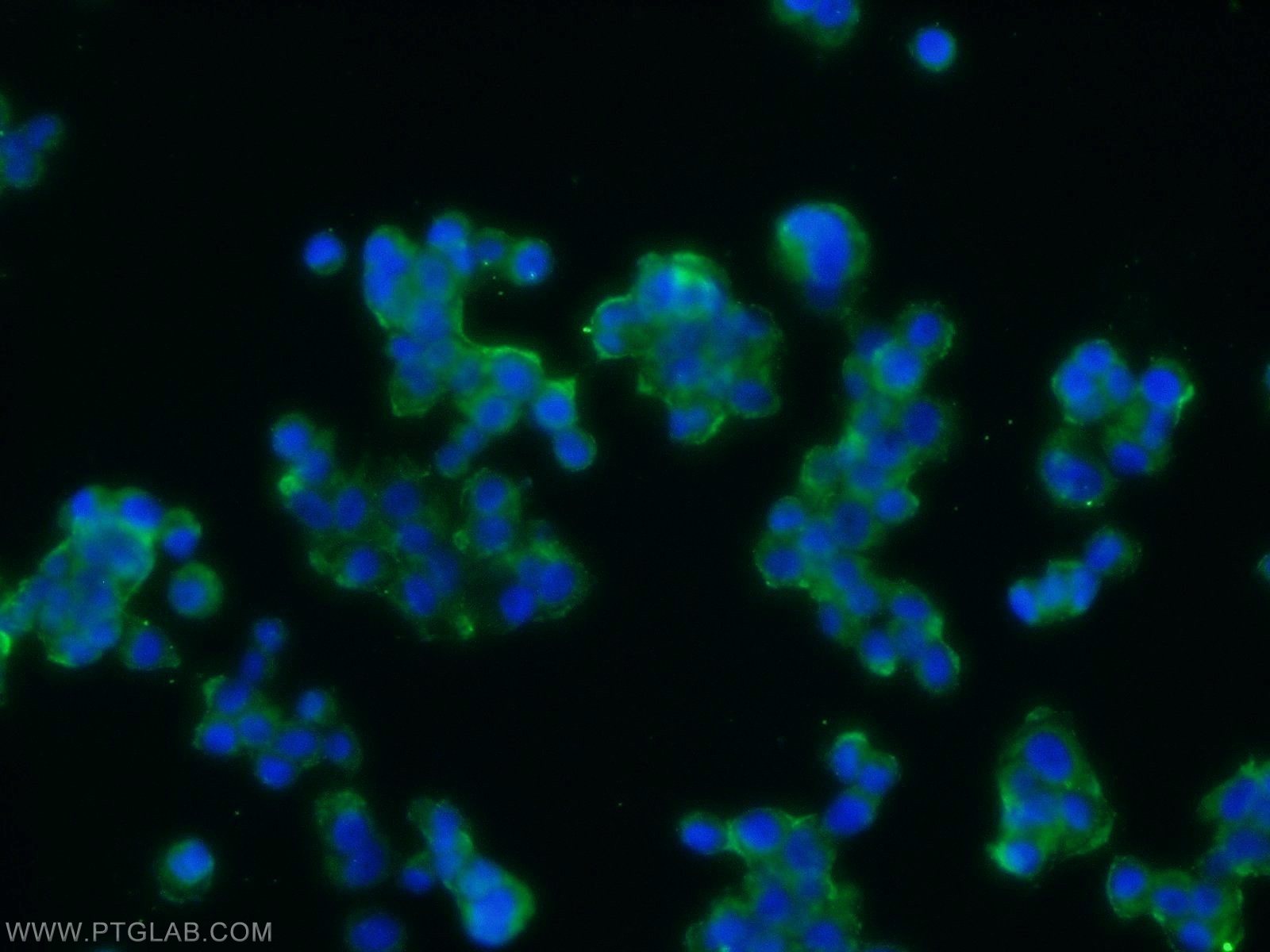 Immunofluorescence (IF) / fluorescent staining of PC-12 cells using ARRDC3 Polyclonal antibody (25060-1-AP)