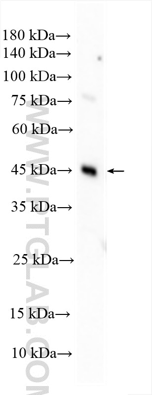 WB analysis of HeLa using 25060-1-AP Western Blot (WB) analysis of HeLa cells using ARRDC3 Polyclonal antibody (25060-1-AP)