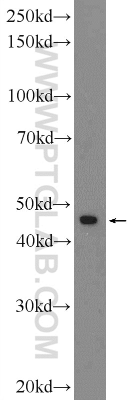 Western Blot (WB) analysis of MCF-7 cells using ARRDC3 Polyclonal antibody (25060-1-AP)
