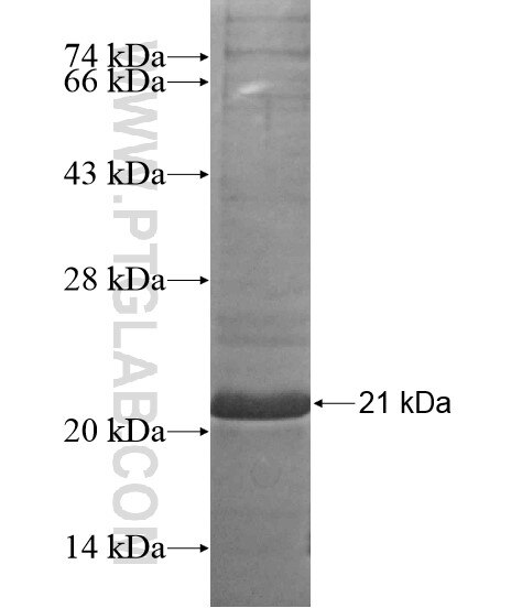 ARRDC3 fusion protein Ag18977 SDS-PAGE