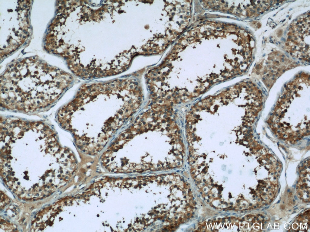 IHC staining of human testis using 19061-1-AP