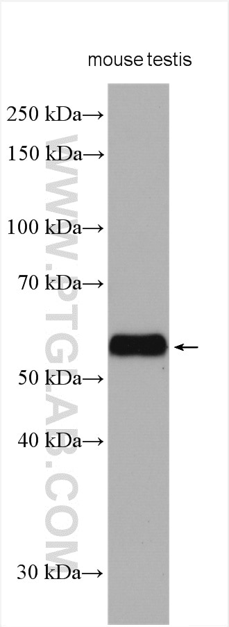 Western Blot (WB) analysis of various lysates using ARSA Polyclonal antibody (19061-1-AP)