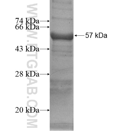 ARSA fusion protein Ag13569 SDS-PAGE