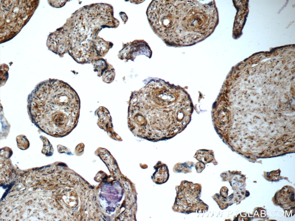 Immunohistochemistry (IHC) staining of human placenta tissue using ARSB Polyclonal antibody (13227-1-AP)