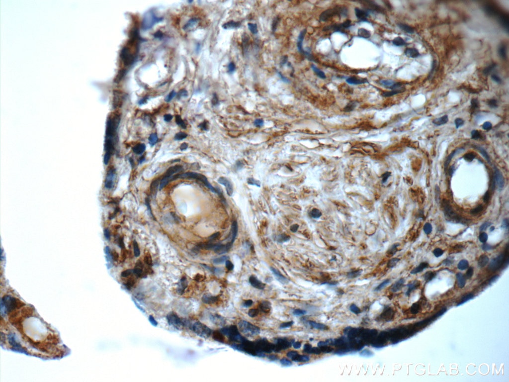 Immunohistochemistry (IHC) staining of human placenta tissue using ARSB Polyclonal antibody (13227-1-AP)