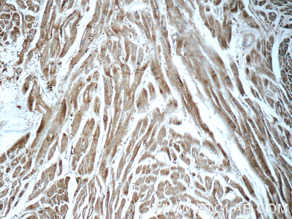 Immunohistochemistry (IHC) staining of human heart tissue using ARSB Polyclonal antibody (13227-1-AP)