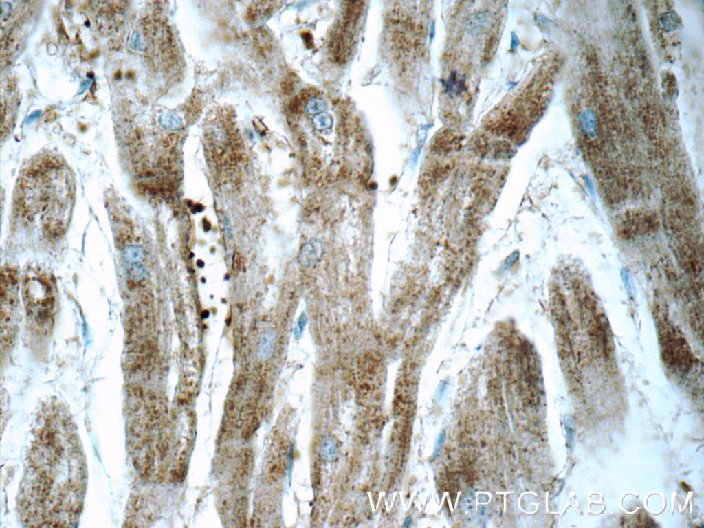 Immunohistochemistry (IHC) staining of human heart tissue using ARSB Polyclonal antibody (13227-1-AP)