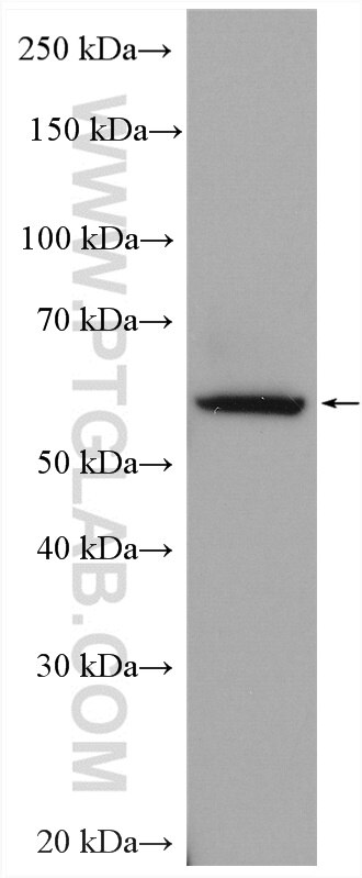 Western Blot (WB) analysis of HepG2 cells using ARSB Polyclonal antibody (13227-1-AP)