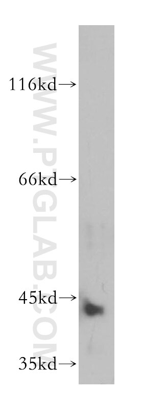 Western Blot (WB) analysis of HepG2 cells using ARSB Polyclonal antibody (13227-1-AP)