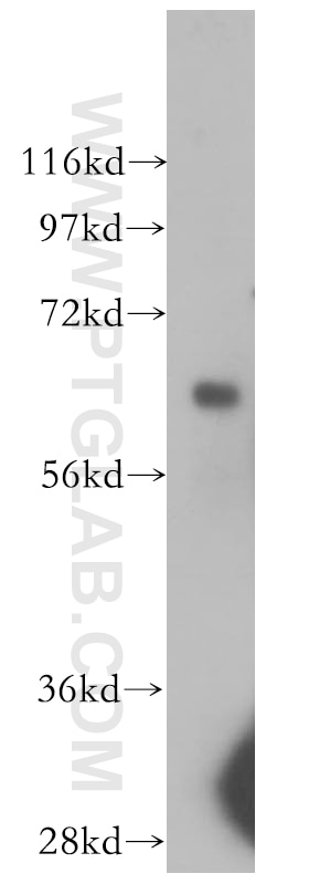 Western Blot (WB) analysis of human placenta tissue using Arylsulfatase D Polyclonal antibody (11805-1-AP)