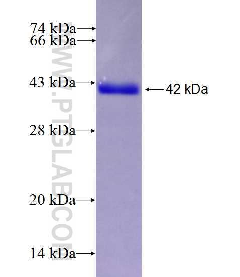ARSD fusion protein Ag27679 SDS-PAGE