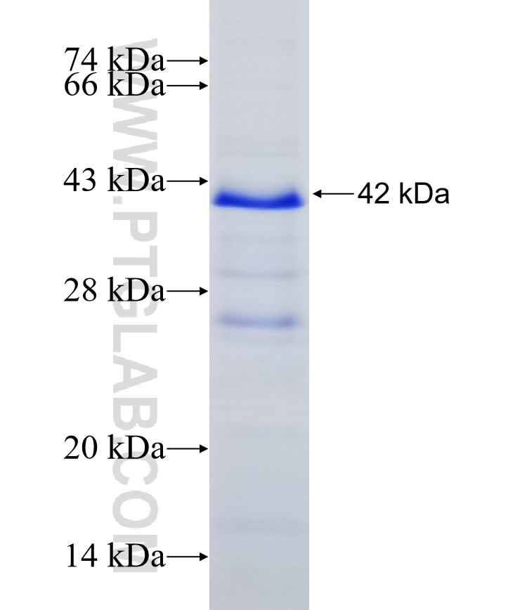 ARSD fusion protein Ag27679 SDS-PAGE