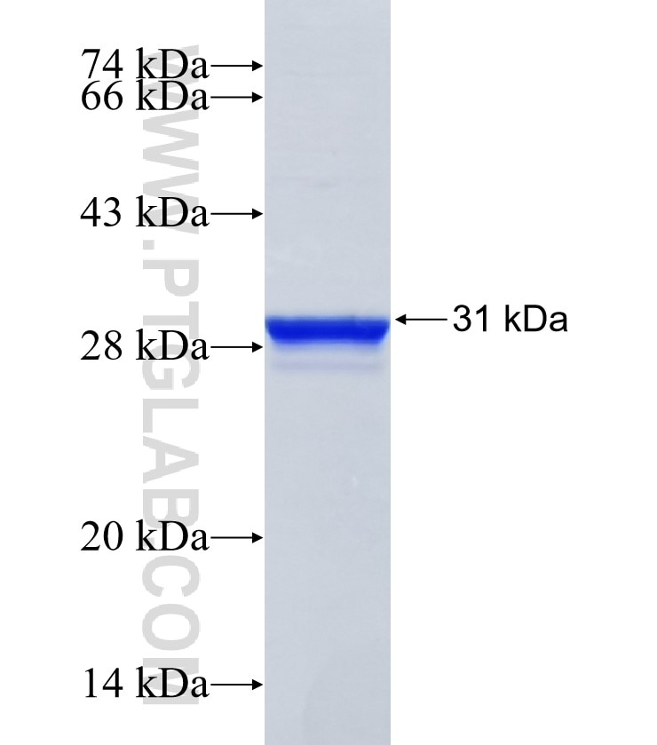 ARSE fusion protein Ag24371 SDS-PAGE