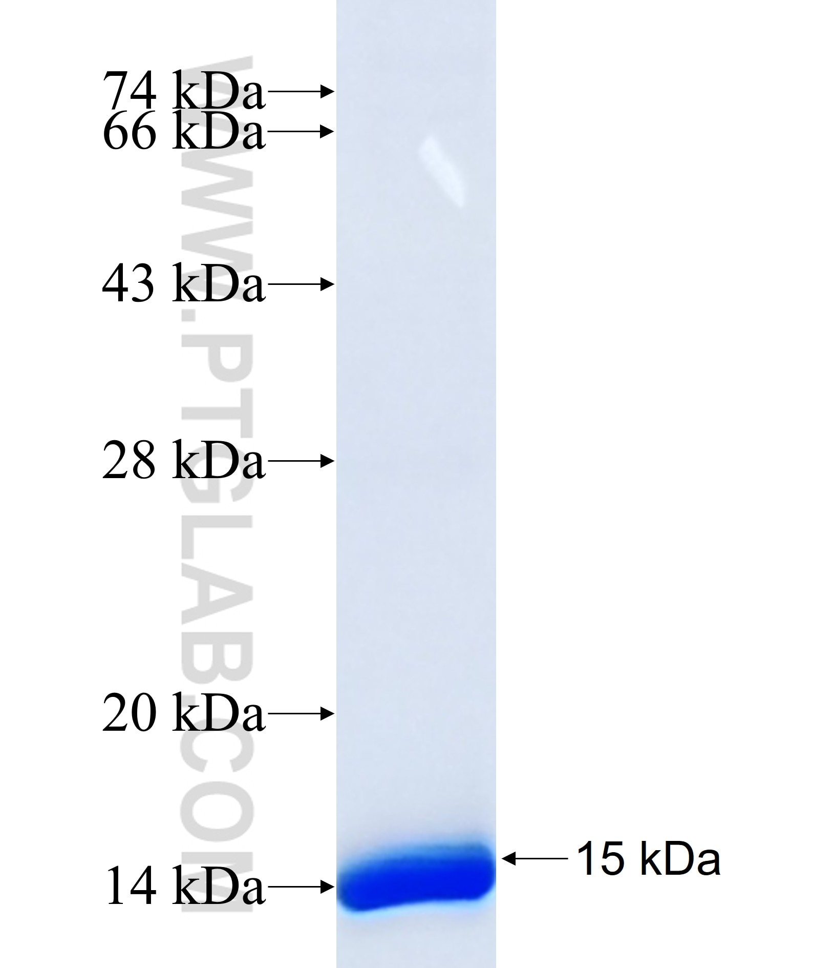 ARSE fusion protein Ag35597 SDS-PAGE ARSE fusion protein Ag35597 SDS-PAGE