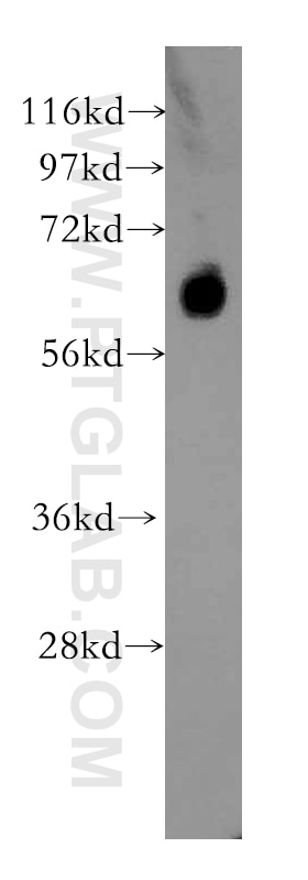 Western Blot (WB) analysis of HEK-293 cells using ARSG Polyclonal antibody (12328-1-AP)