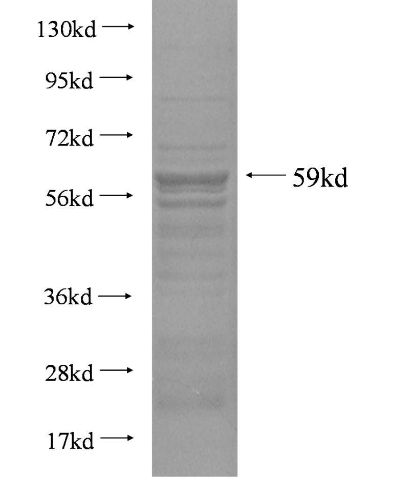 ARSG fusion protein Ag2991 SDS-PAGE