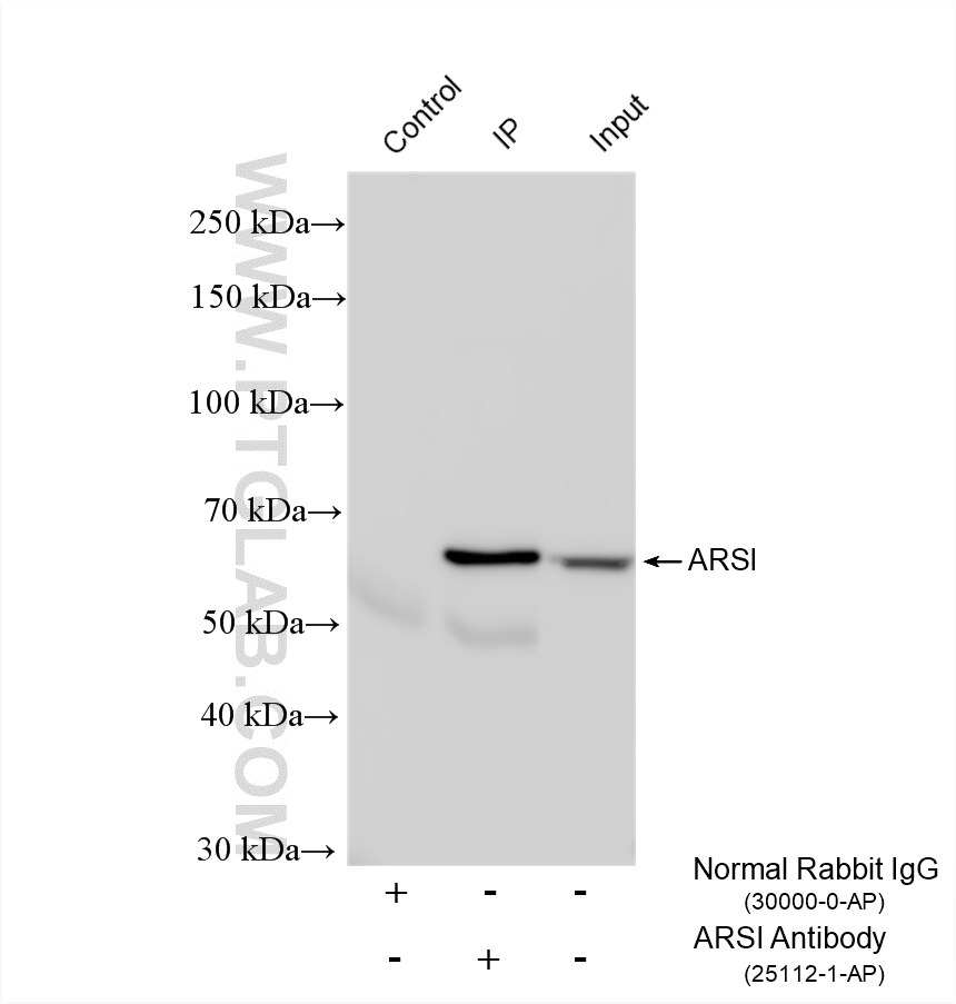 IP experiment of A549 using 25112-1-AP Immunoprecipitation (IP) experiment of A549 cells using ARSI Polyclonal antibody (25112-1-AP)