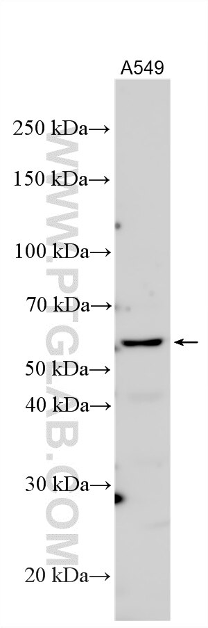 WB analysis of A549 using 25112-1-AP Western Blot (WB) analysis of A549 cells using ARSI Polyclonal antibody (25112-1-AP)