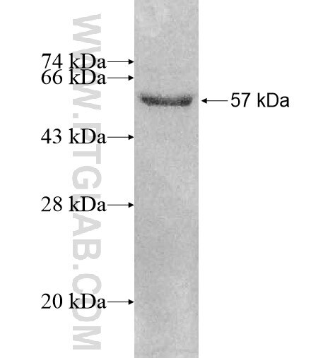 ARSJ fusion protein Ag10993 SDS-PAGE