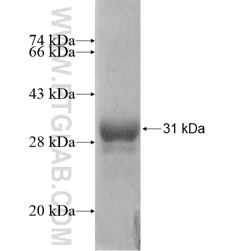 ARSJ fusion protein Ag11239 SDS-PAGE