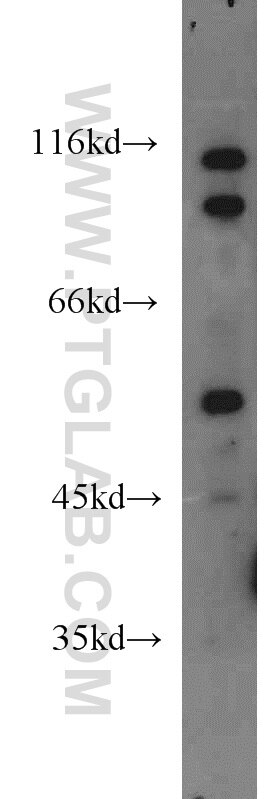 WB analysis of HeLa using 19749-1-AP