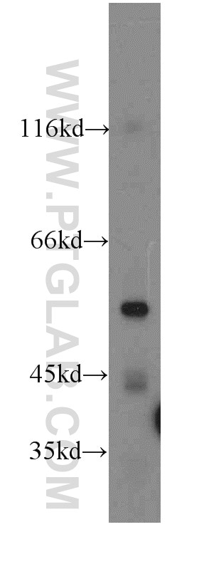 Western Blot (WB) analysis of HeLa cells using ARSK-Specific Polyclonal antibody (19749-1-AP)