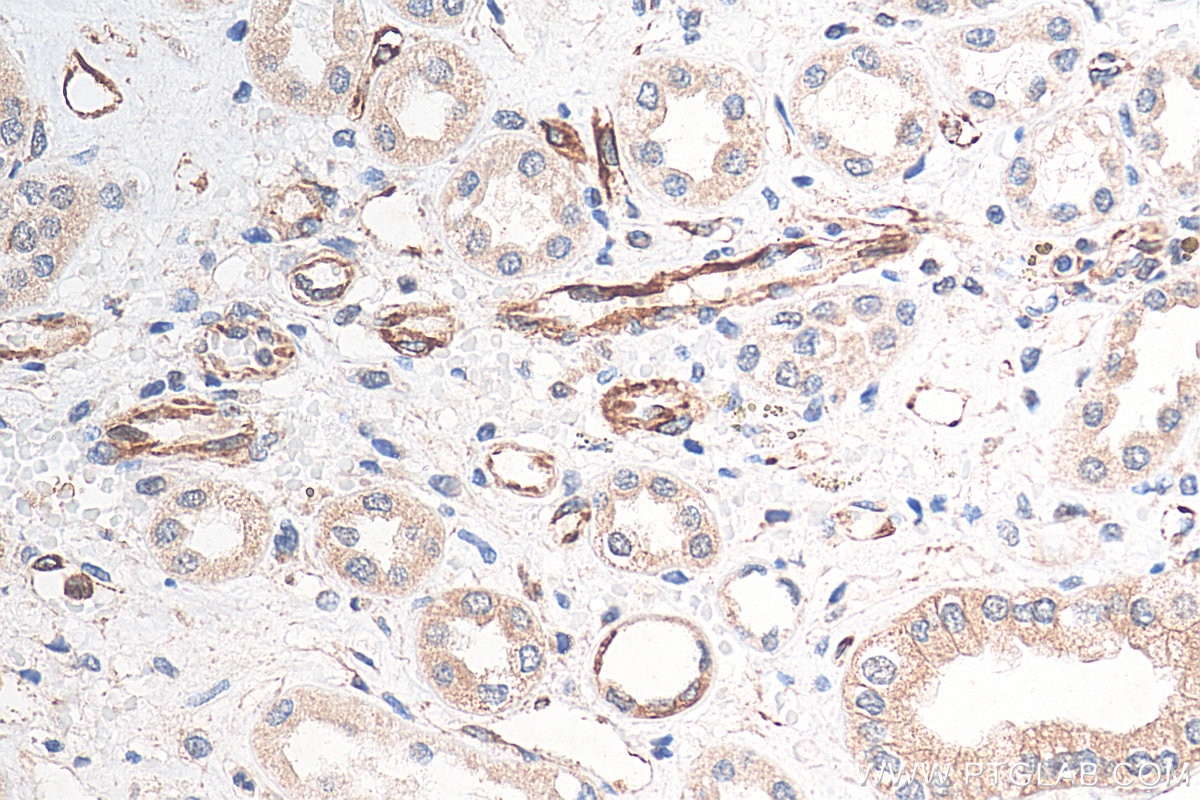 Immunohistochemistry (IHC) staining of human kidney tissue using ART1 Monoclonal antibody (66958-1-Ig)