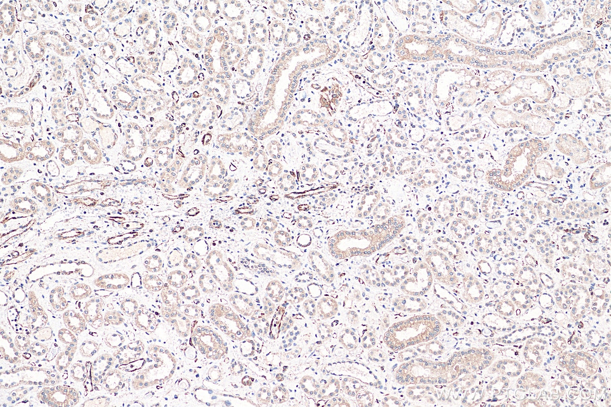 Immunohistochemistry (IHC) staining of human kidney tissue using ART1 Monoclonal antibody (66958-1-Ig)