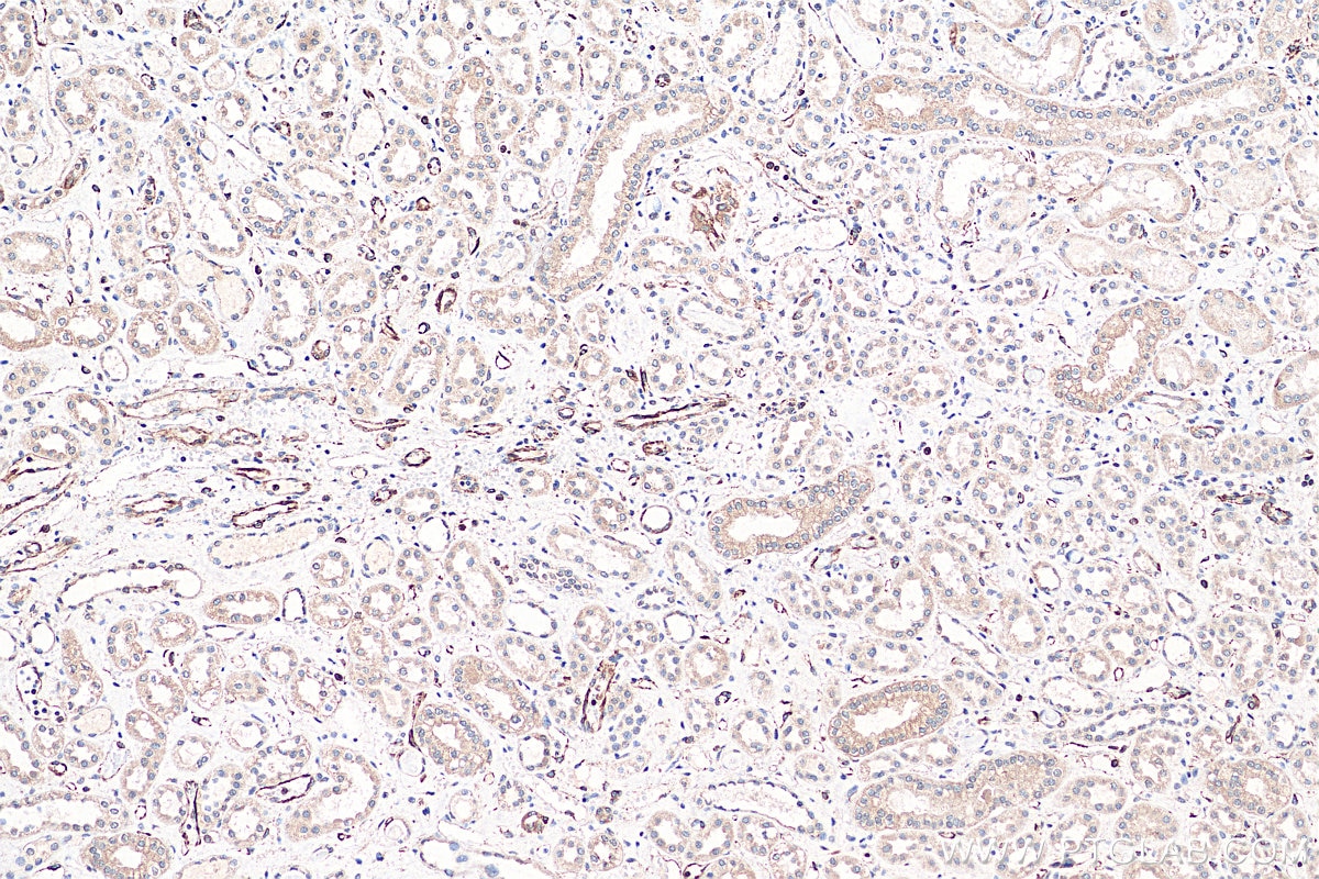 Immunohistochemistry (IHC) staining of human kidney tissue using ART1 Monoclonal antibody (66958-1-Ig)