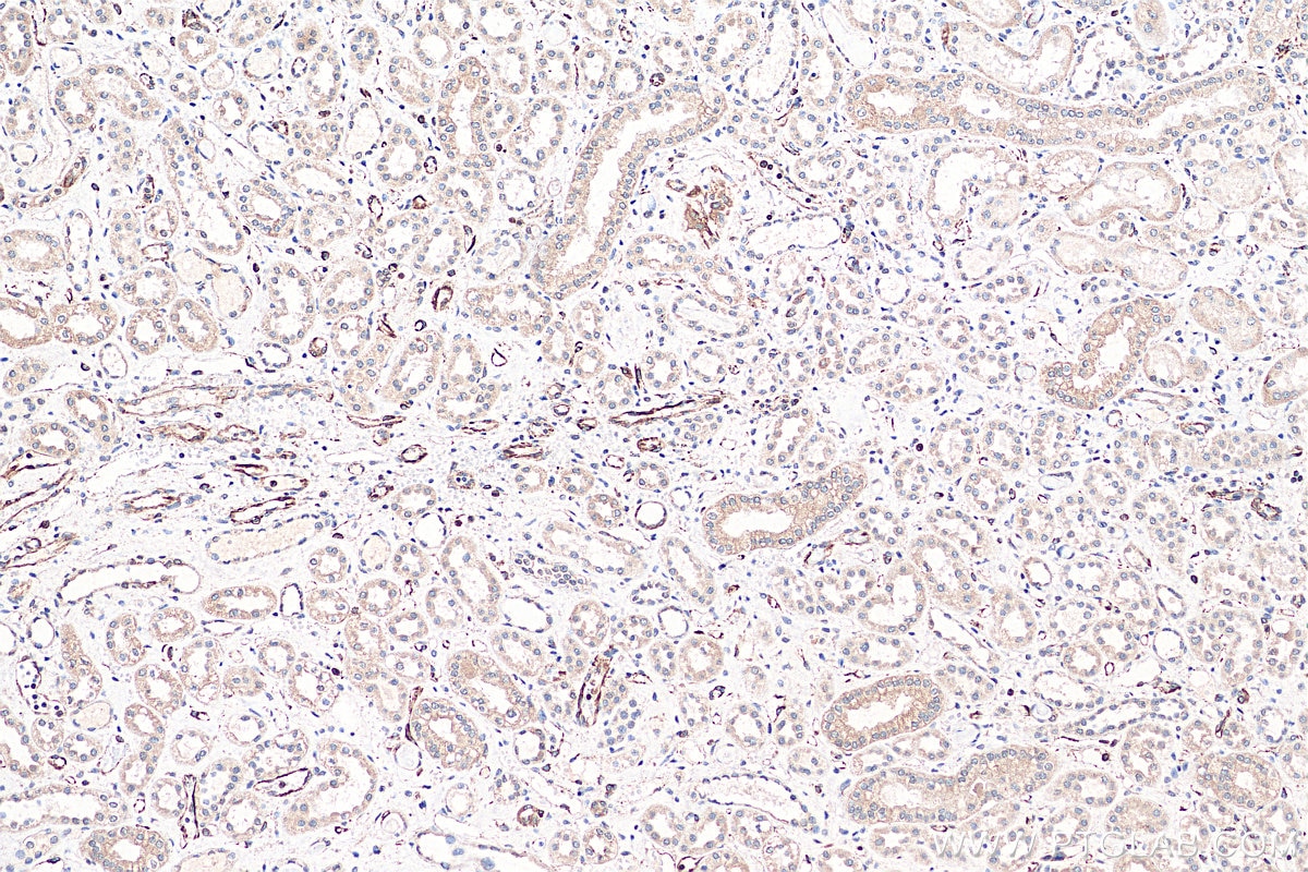 IHC staining of human kidney using 66958-1-Ig