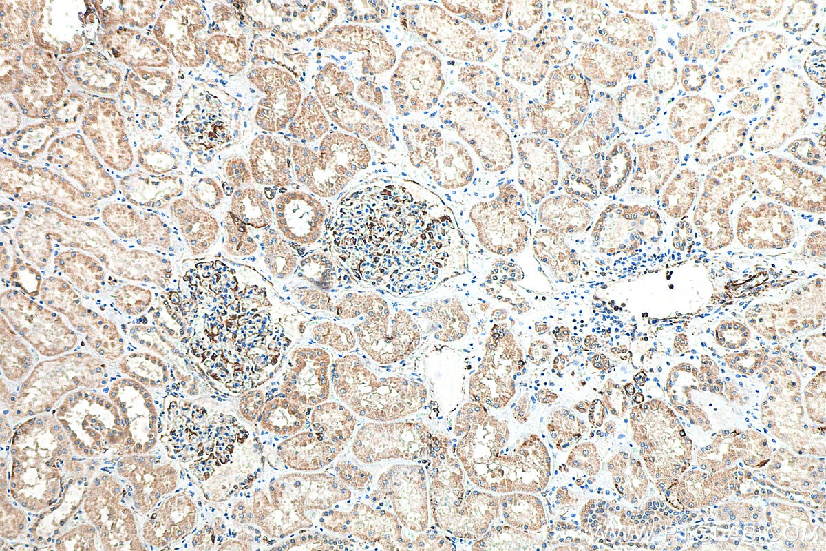 IHC staining of human kidney using 66958-1-Ig